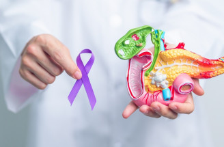 Rakovina pankreasu – spoznajte jej druhy, príčiny vzniku, varovné príznaky aj možnosti prevencie!