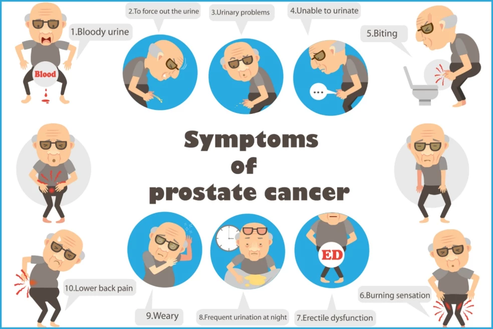 prejavy rakoviny prostaty