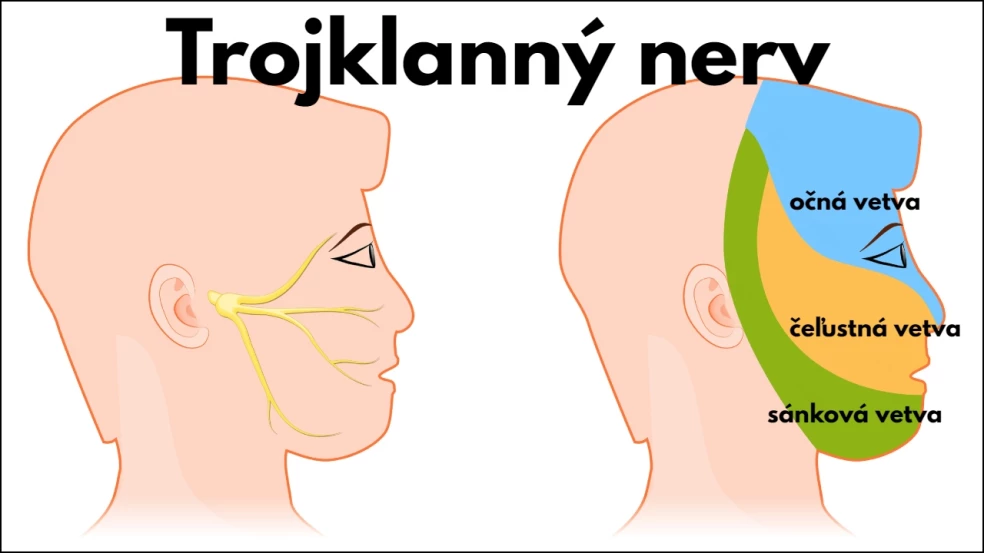 trojklanný nerv