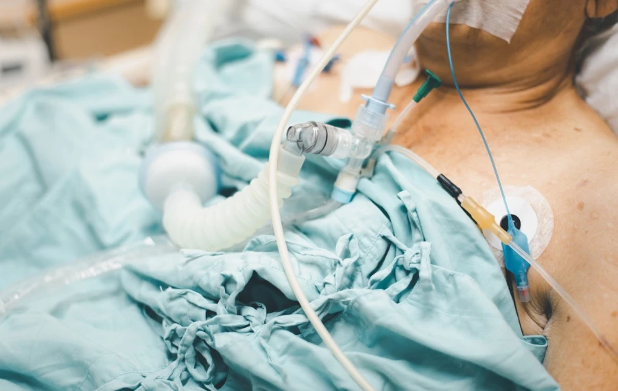 Umelá pľúcna ventilácia