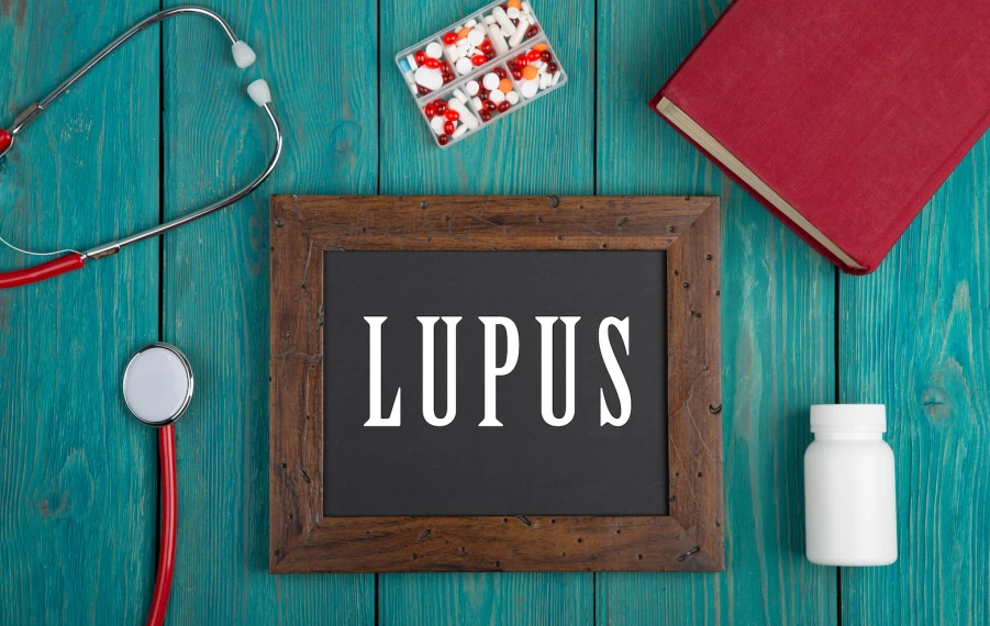 lupus