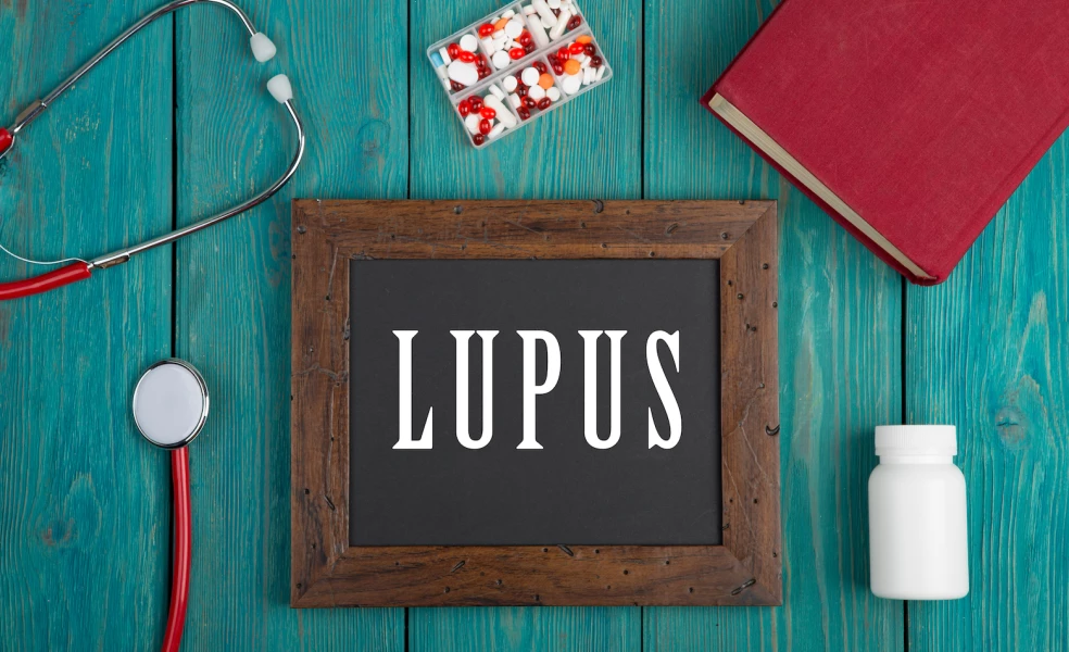 lupus