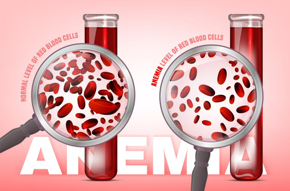 nedostatok červených krviniek
