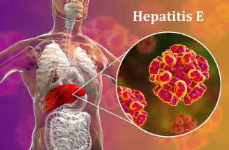 Hepatitída E – aké sú možnosti prenosu a aké ťažkosti spôsobuje?