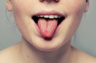 Čo prezrádza jazyk o našom zdraví? Pozor, môže to byť aj závažné ochorenie