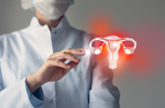 Endometrióza – aké príznaky na ňu môžu u žien poukazovať?