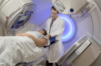 Rádioterapia pri liečbe rakoviny – ako funguje a aké nežiaduce účinky prináša?
