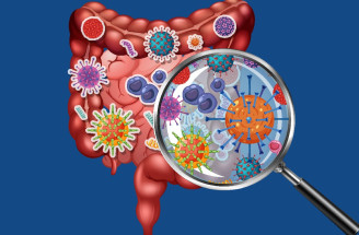 Čo je SIBO? Prečo tento zdravotný problém vzniká a aké sú príznaky?