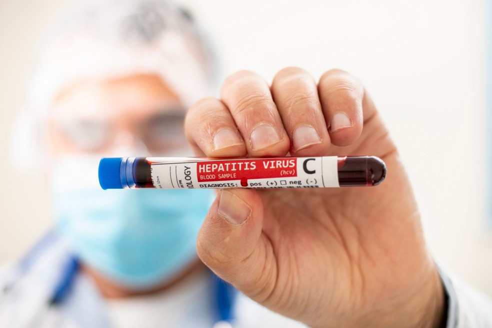 liečba hepatitídy C