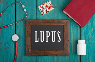 Ochorenie lupus: Poznáš túto vážnu chorobu mnohých tvárí?