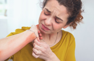 Alergia na nikel – ako sa prejavuje a ako predísť ťažkostiam?