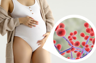 Vaginálna mykóza v tehotenstve – prečo je u tehotných žien vyššie riziko a ako postupovať pri liečbe?