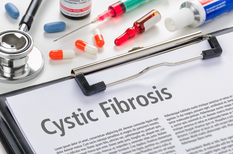 prejavy cystickej fibrózy