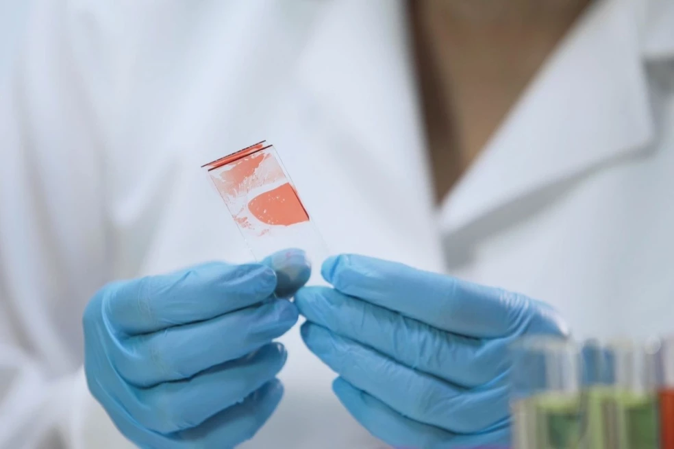 hepatitída príznaky