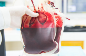 TOP zaujímavosti o ľudskej krvi: Z čoho sa skladá a koľko jej máme?