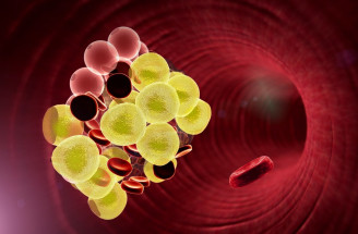 Krvné zrazeniny – čo zvyšuje riziko ich výskytu a ako im predchádzať?