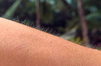 Zistite, čo znamená zimnica: Kedy signalizuje vážny problém?