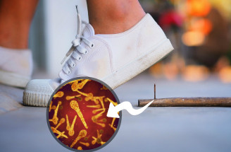 Ako sa prejavuje tetanus? Čo o tomto vážnom ochorení musíme vedieť?