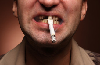 9 zlozvykov, ktorými si ničíme zuby: Čo nerobiť, aby nám vydržali do staroby?