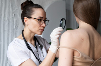 Čo je dermatoskopia? Nezabúdajte na pravidelnú kontrolu znamienok