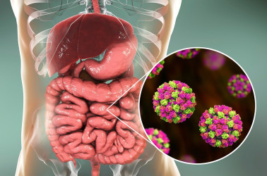 Norovírus – aké ochorenie spôsobuje a aké sú hlavné príznaky?