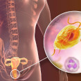Trichomoniáza: Aké prejavy má táto pohlavne prenosná choroba? Aké sú možnosti nákazy?