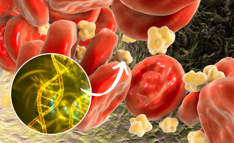 Familiárna hypercholesterolémia