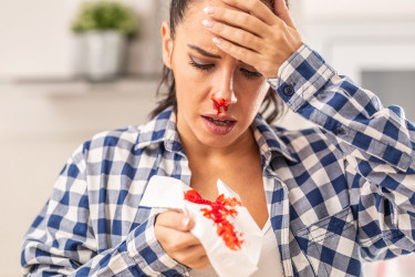 Časté krvácanie z nosa – môžu za problémom stáť vážnejšie príčiny?