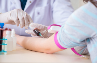 Hormonálny profil – kedy sa odporúča laboratórne vyšetrenie hladín hormónov?