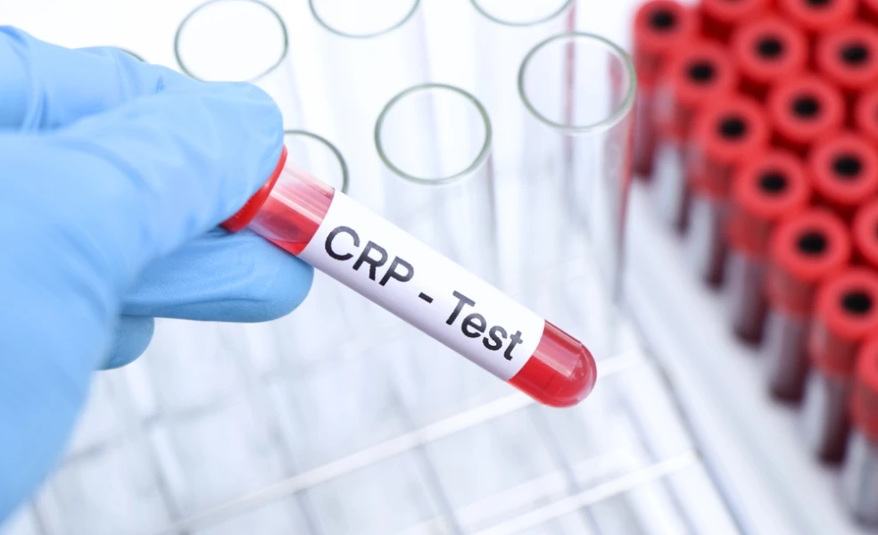 CRP test