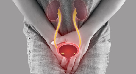 Močové kamene – koho môžu postihnúť a ako sa ich zbaviť?