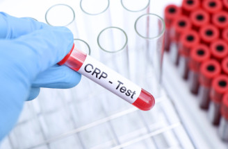 CRP test: Čo to je, ako sa robí a čo ukazujú výsledky a hodnoty?