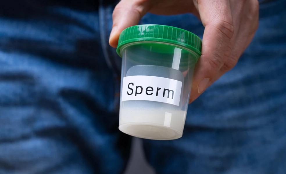 spermiogram