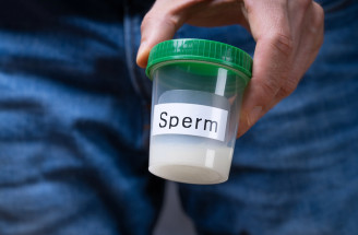 Spermiogram: Prvý krok k odhaleniu mužskej plodnosti. Príprava, priebeh, výsledky