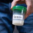 Spermiogram: Prvý krok k odhaleniu mužskej plodnosti. Príprava, priebeh, výsledky