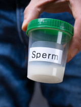 Spermiogram: Prvý krok k odhaleniu mužskej plodnosti. Príprava, priebeh, výsledky
