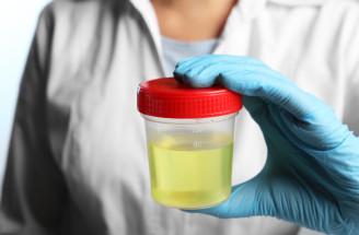 Uroflowmetria: Kľúčová metóda na diagnostiku problémov s močovým mechúrom