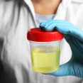 Uroflowmetria: Kľúčová metóda na diagnostiku problémov s močovým mechúrom