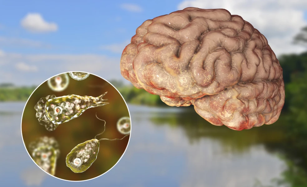Naegleria fowleri
