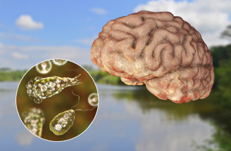 Améba Naegleria fowleri (slzovnička zhubná) – čo treba vedieť o tejto vážnej infekcii mozgu?