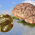 Améba Naegleria fowleri (slzovnička zhubná) – čo treba vedieť o tejto vážnej infekcii mozgu?