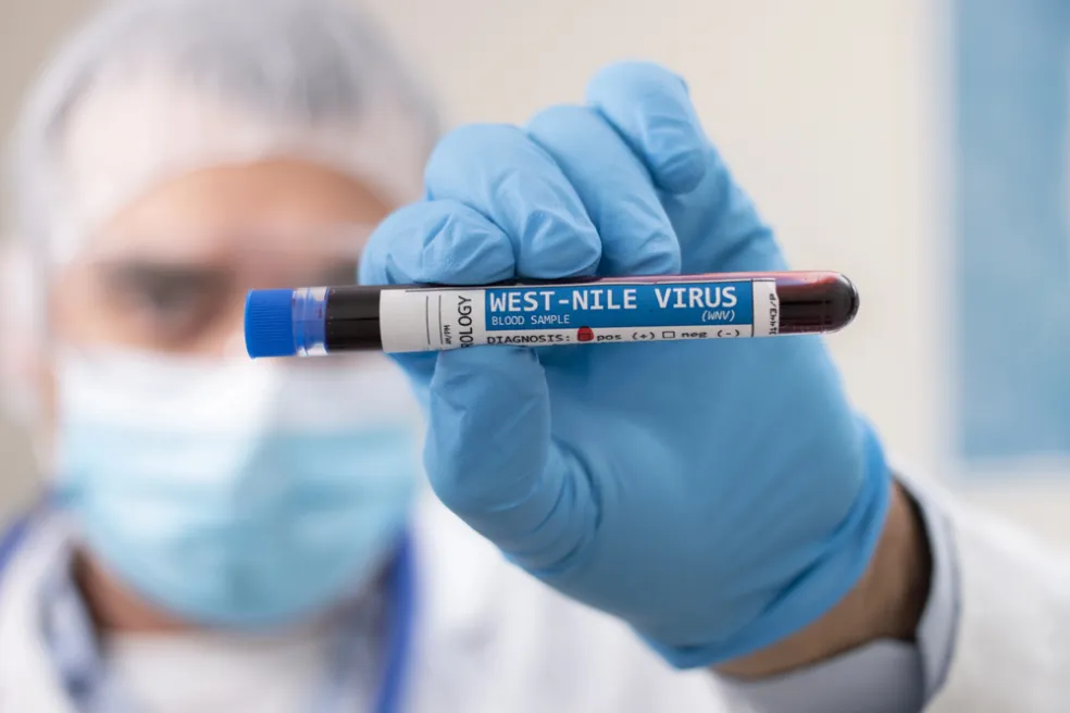 Diagnostika západonílskeho vírusu
