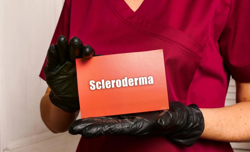Sklerodermia