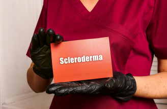 Sklerodermia: Zriedkavé ochorenie, ktoré mení kožu aj orgány. Prečo vzniká?