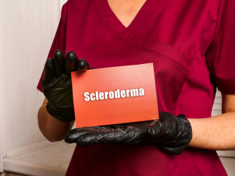 Sklerodermia: Zriedkavé ochorenie, ktoré mení kožu aj orgány. Prečo vzniká?