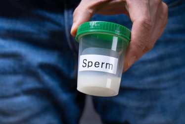 Spermiogram: Prvý krok k odhaleniu mužskej plodnosti. Príprava, priebeh, výsledky