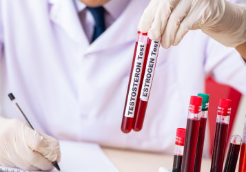 Testosterón u žien – aký má význam a ako sa prejaví nadbytok?