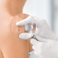 Kožné zmeny neignorujte! Pri týchto 7 príznakoch treba navštíviť dermatológa