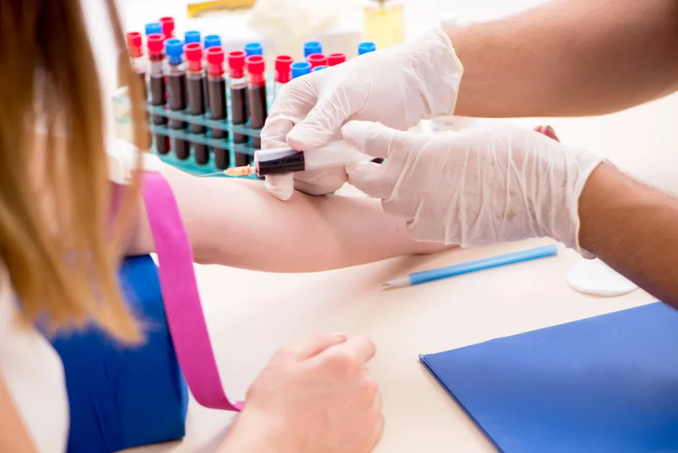 Diagnostika hladiny luteinizačného hormónu