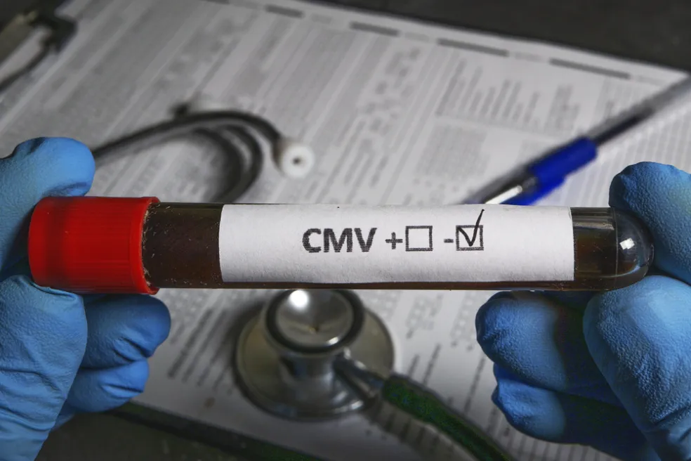 Diagnostika CMV infekcie 